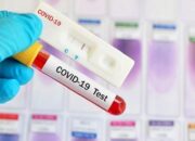 Covid-19 Purwakarta, Jumlah Angka Warga Terpapar Tidak Bergerak