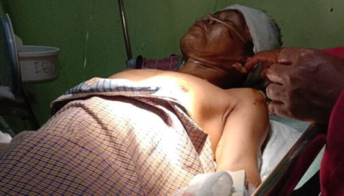 Babi Hutan Seruduk Momo, Warga Banyuasih Taraju