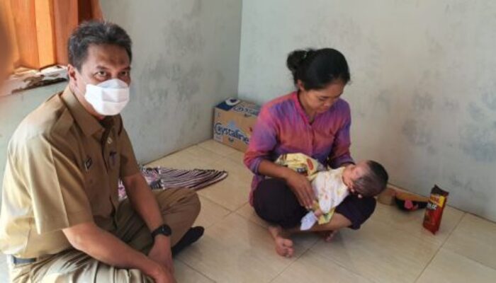 Dinkes Majalengka Bantu Sabira, Bocah Penderita Hidrosefalus