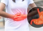 Tips Atasi Gejala Keracunan Makanan