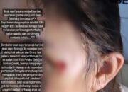 Diduga Dianiaya Teman Sekolah, Orang Tua di Kota Tasik Curhat ke Medsos