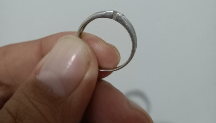 Waduh, Cincin Tersangkut di Area Sensitif Pria